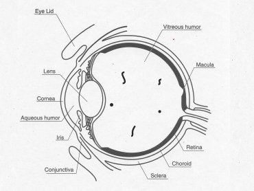 Corneal Abscess